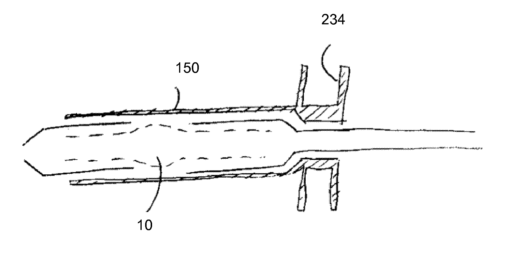 Stent-valve, delivery apparatus and method of use