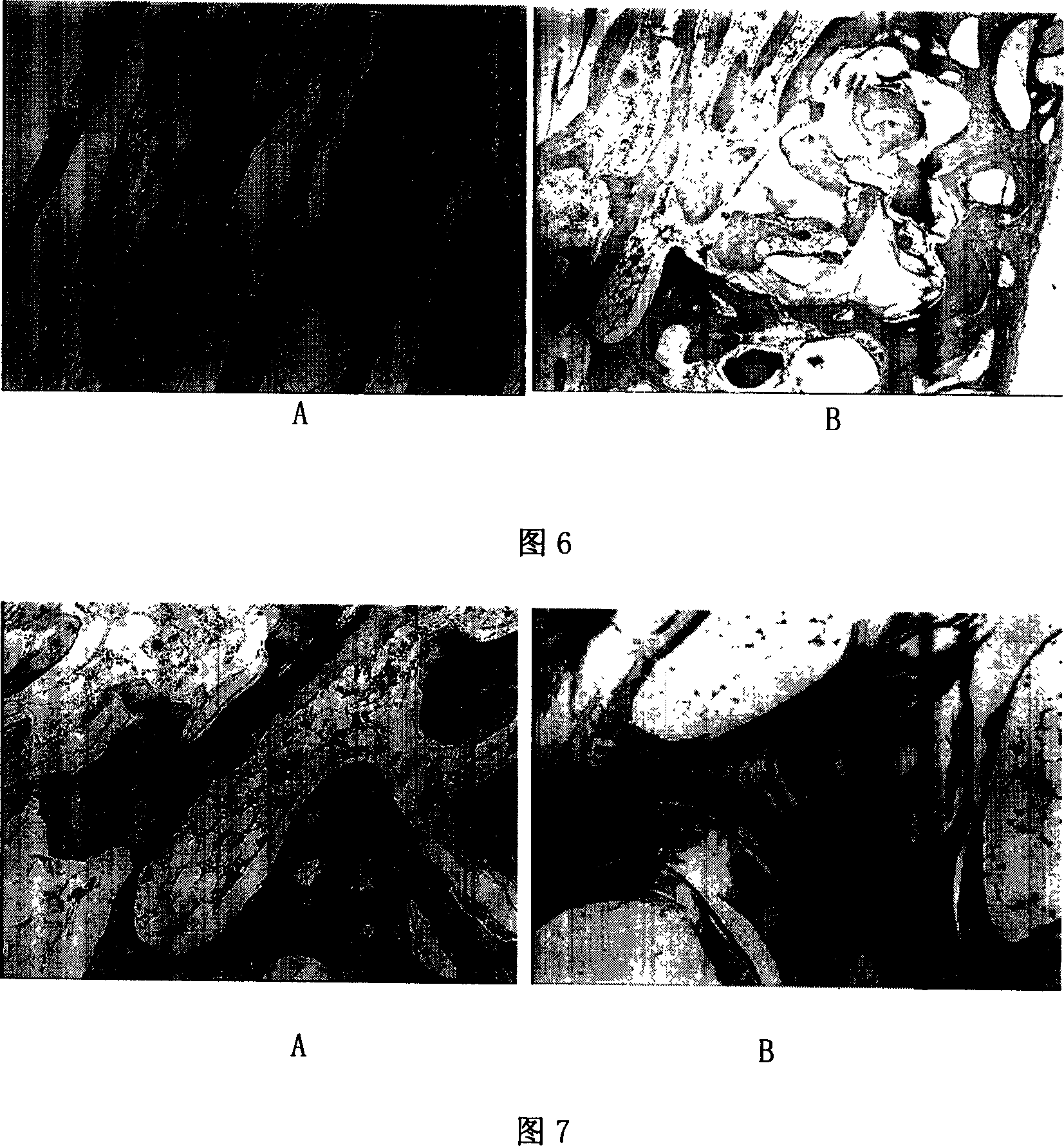 Bone repairing material and its prepn process and use