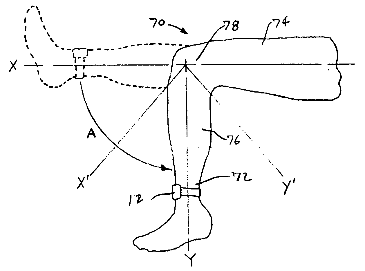 Apparatus and method for evaluating a hypertonic condition