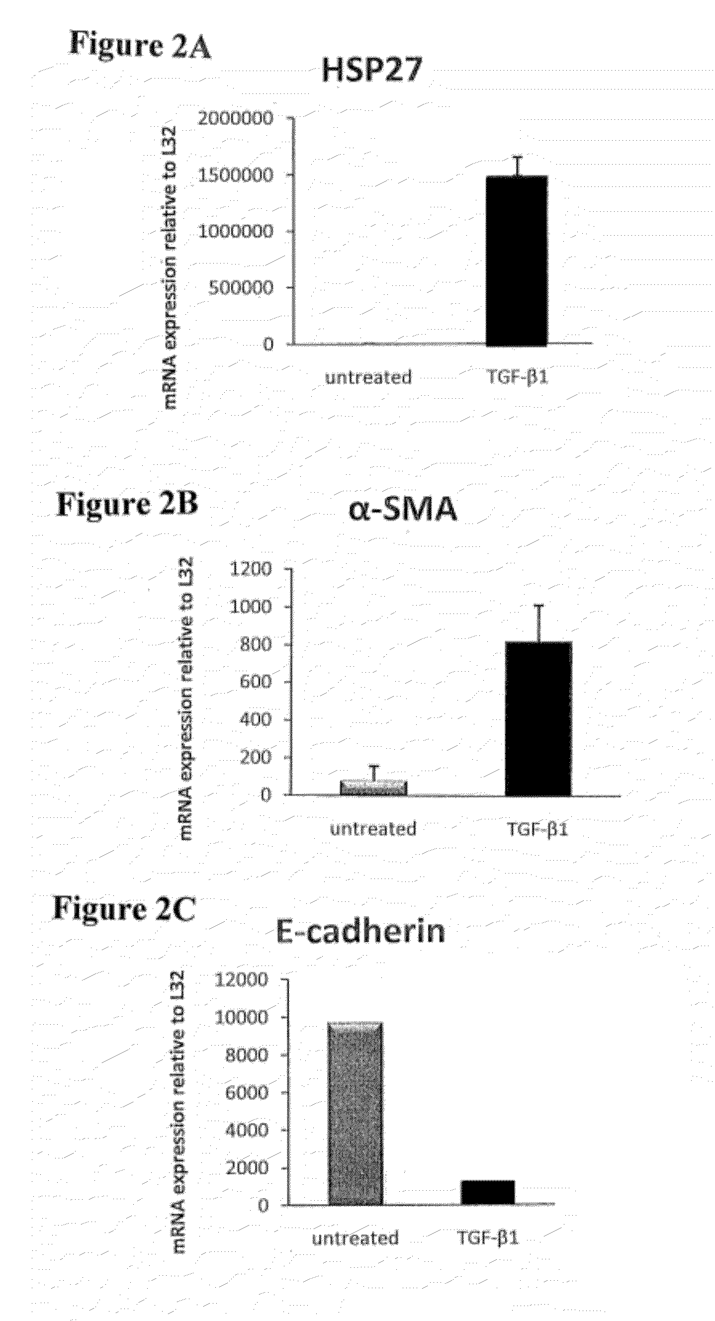 Treatment of Pulmonary and Pleural Fibrosis Using HSP27 Inhibitors