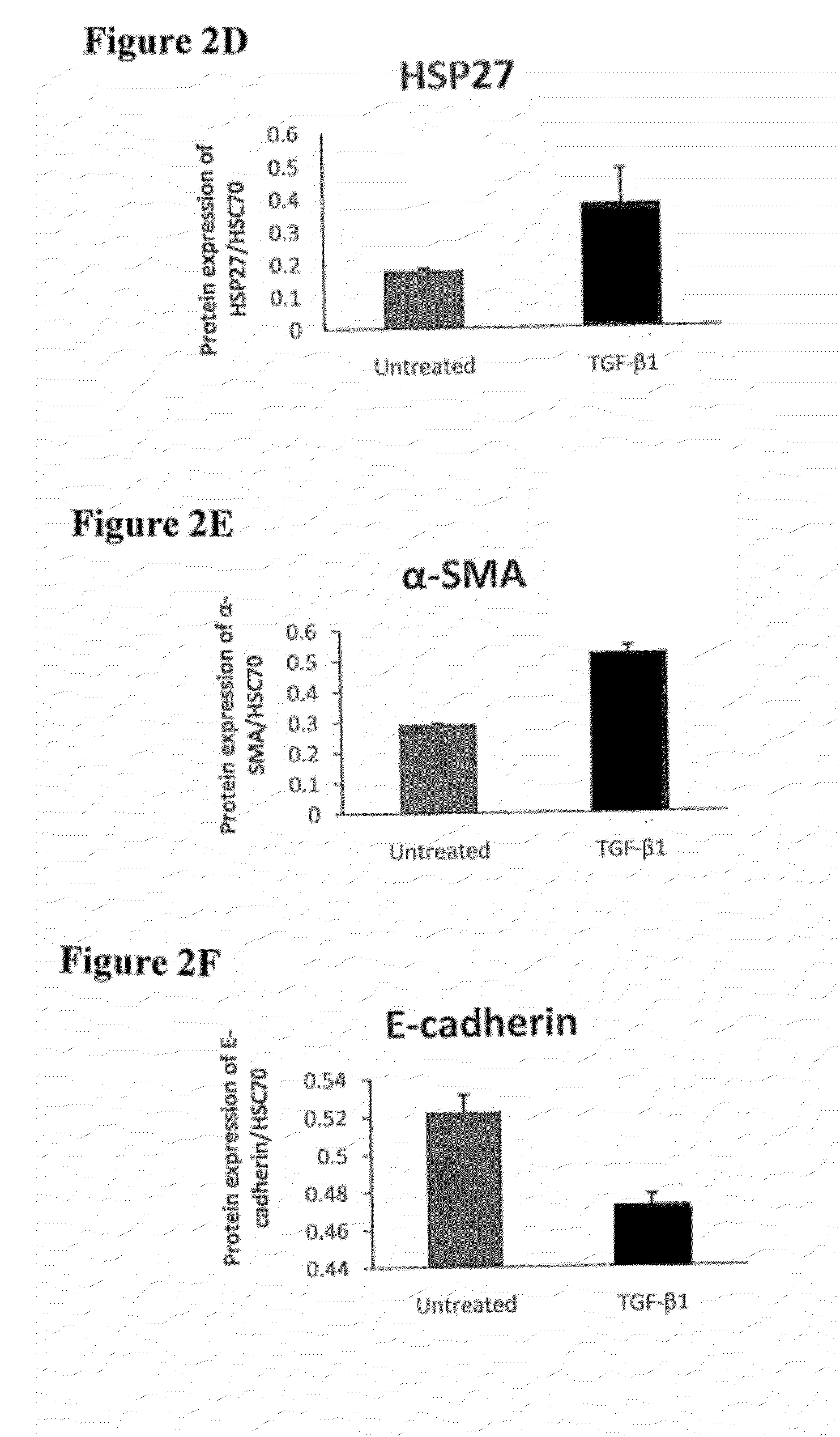 Treatment of Pulmonary and Pleural Fibrosis Using HSP27 Inhibitors