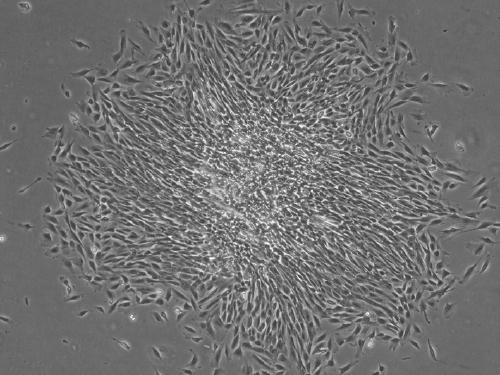 Isolated culture method for human endometrial tissue-derived endothelial progenitor cell