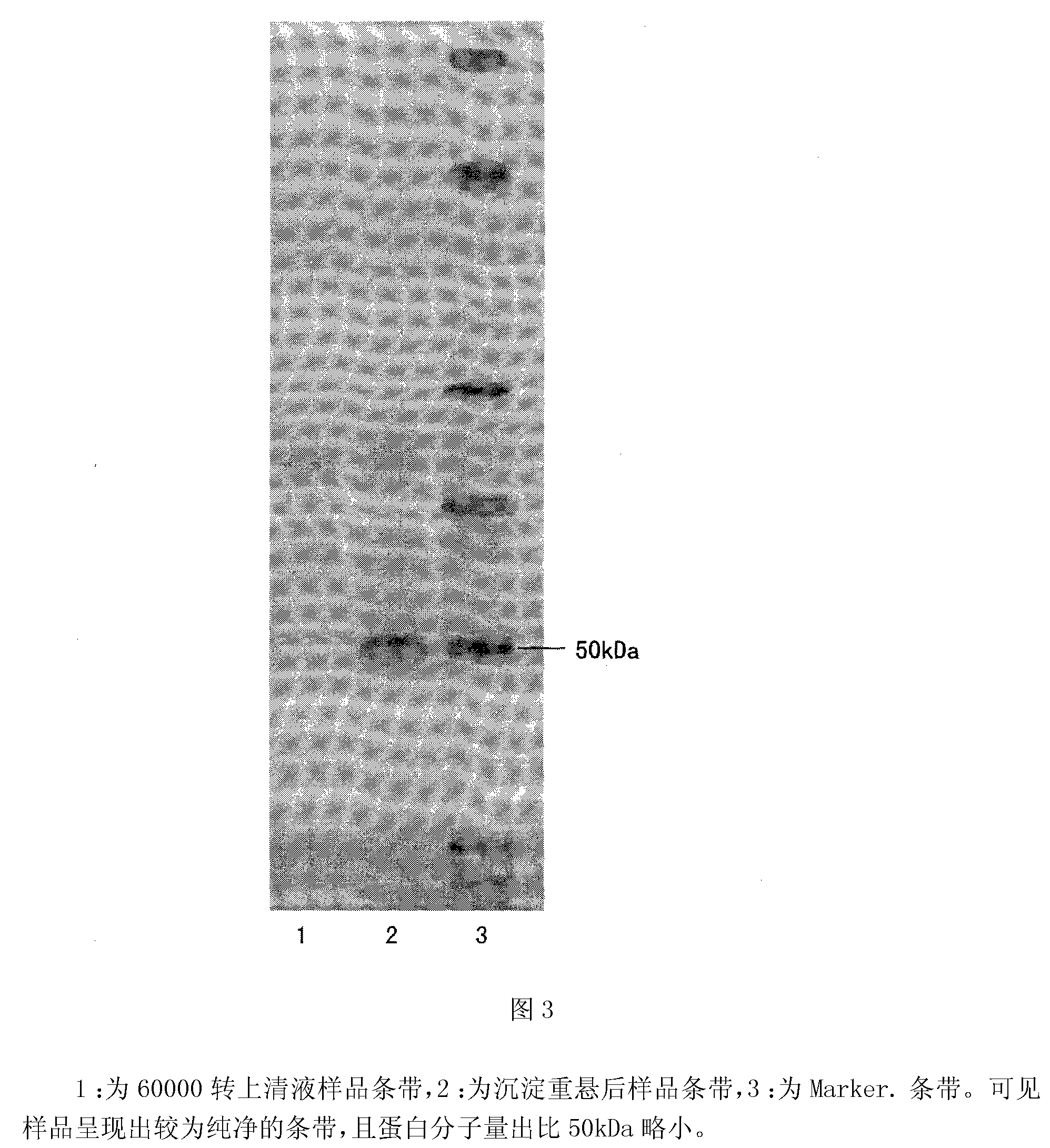 Gelatin particle-agglutination detection reagent kit suitable for 1type duck hepatitis virus antibody and its uses