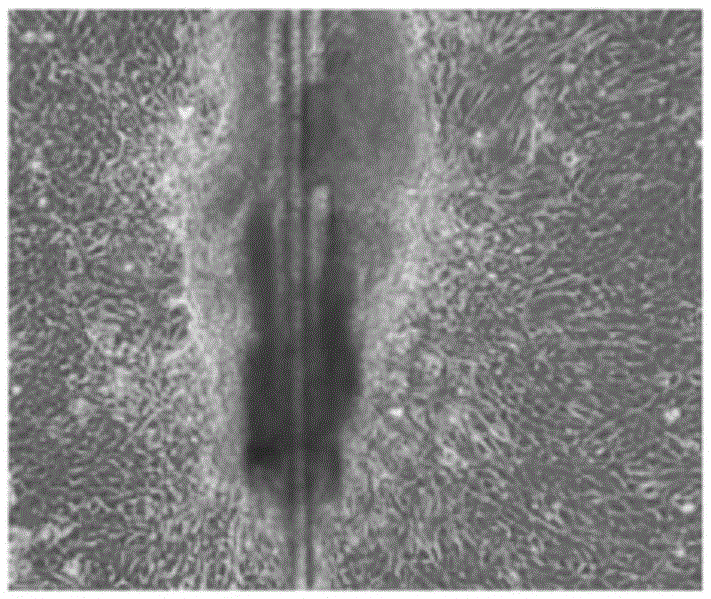 Inhibition method for induced differentiation of hair follicle stem cells into vascular endothelial cells