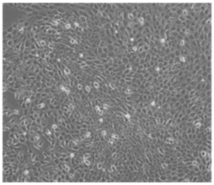 Inhibition method for induced differentiation of hair follicle stem cells into vascular endothelial cells