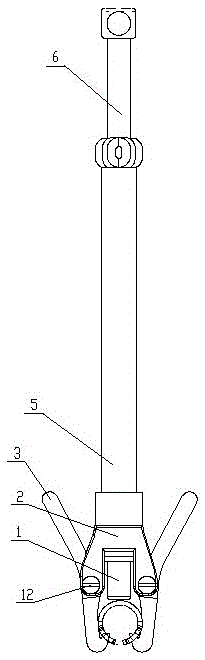 Memory alloy embracing type clavicle connector extractor