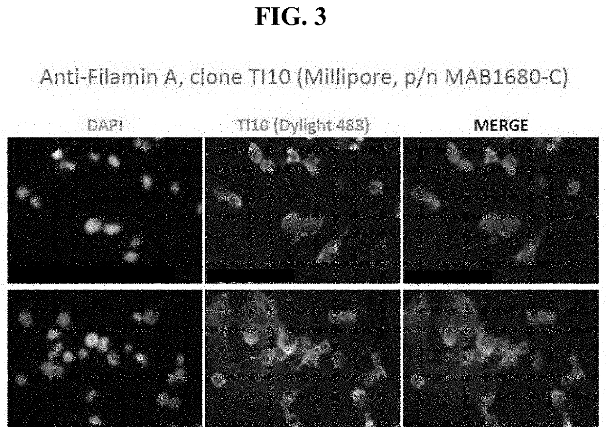 Antibodies directed to filamin-a and therapeutic uses thereof