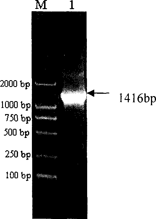 Pneumococcus polysaccharide protein coupling vaccine and its preparing method