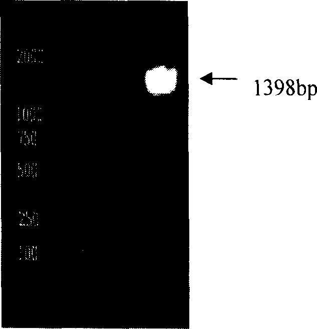 Pneumococcus polysaccharide protein coupling vaccine and its preparing method