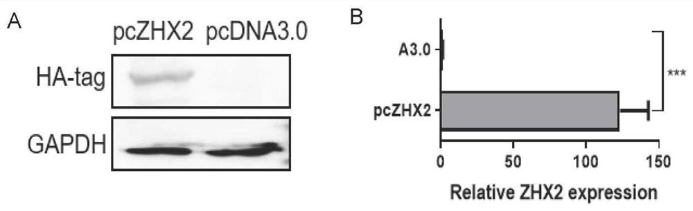 Application of transcription factor ZHX2 in the regulation of NK cells