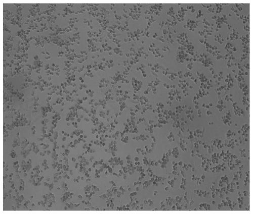 SARS-CoV-2 inactivated vaccine and preparation method of vaccine