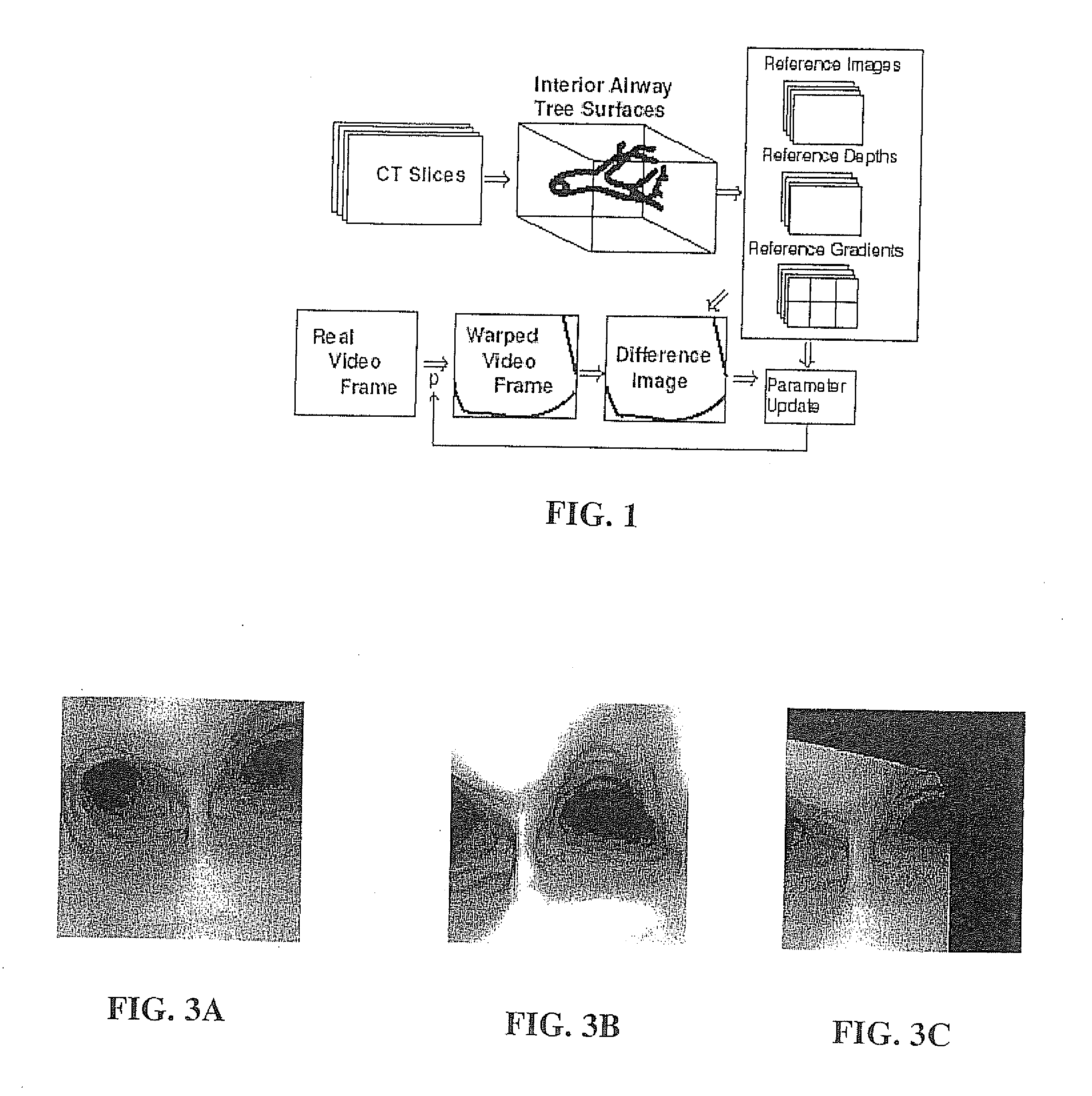 Fast 3d-2d image registration method with application to continuously guided endoscopy