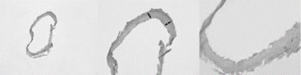 Mold for manufacturing aneurysm model and method