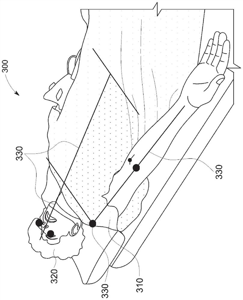 Guided lung coverage and automatic detection using ultrasound device