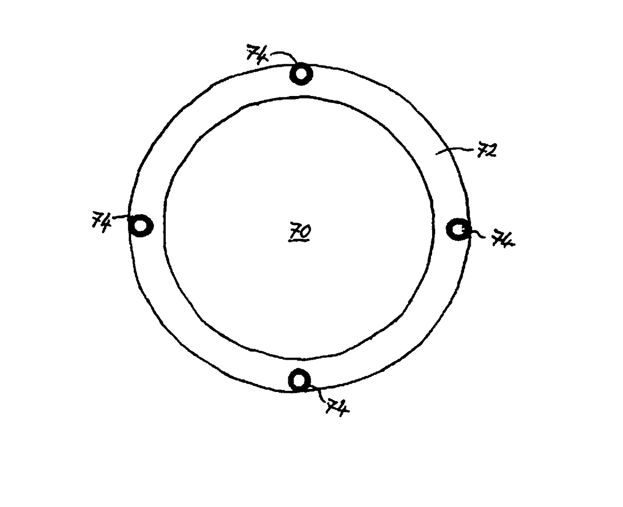 Intraocular implant and method for fixing same into an eye