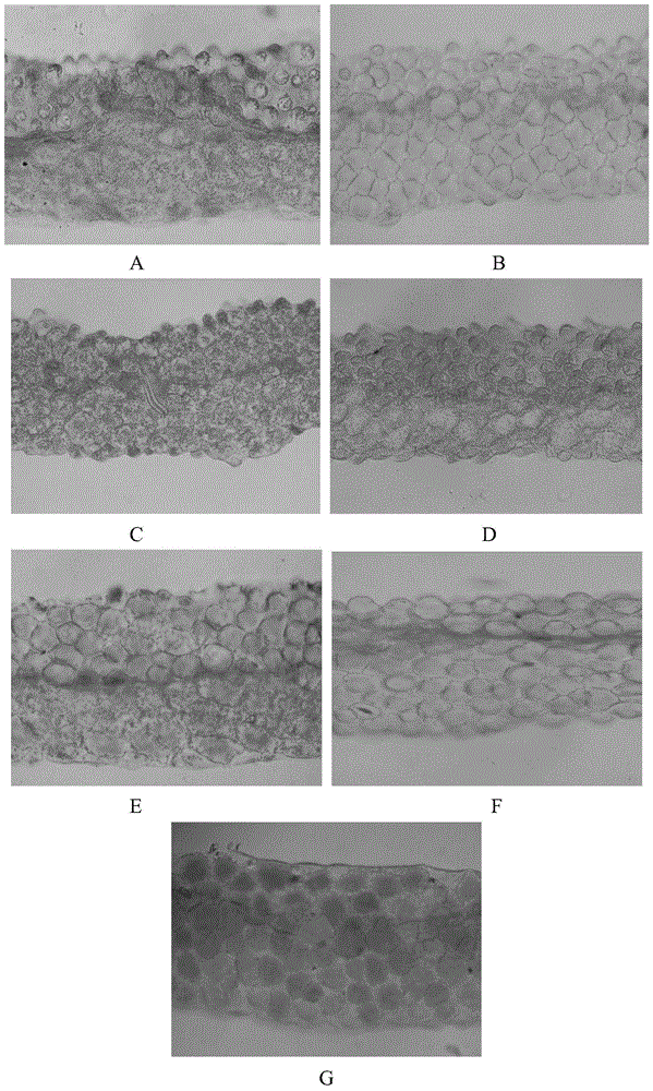 Application of interfering expression of lcyb and lcye while overexpressing pap in preparing Brassica plants with red petals