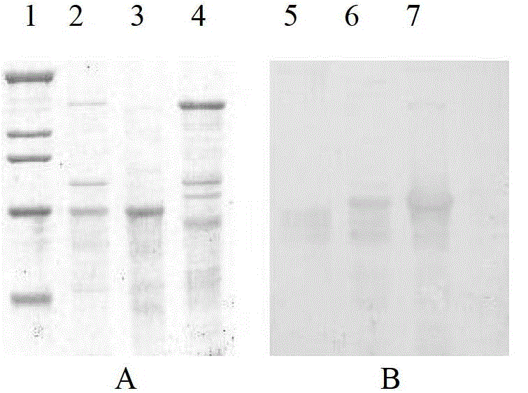 Bacillus thuringiensis gene combination and engineering bacteria and preparation method thereof