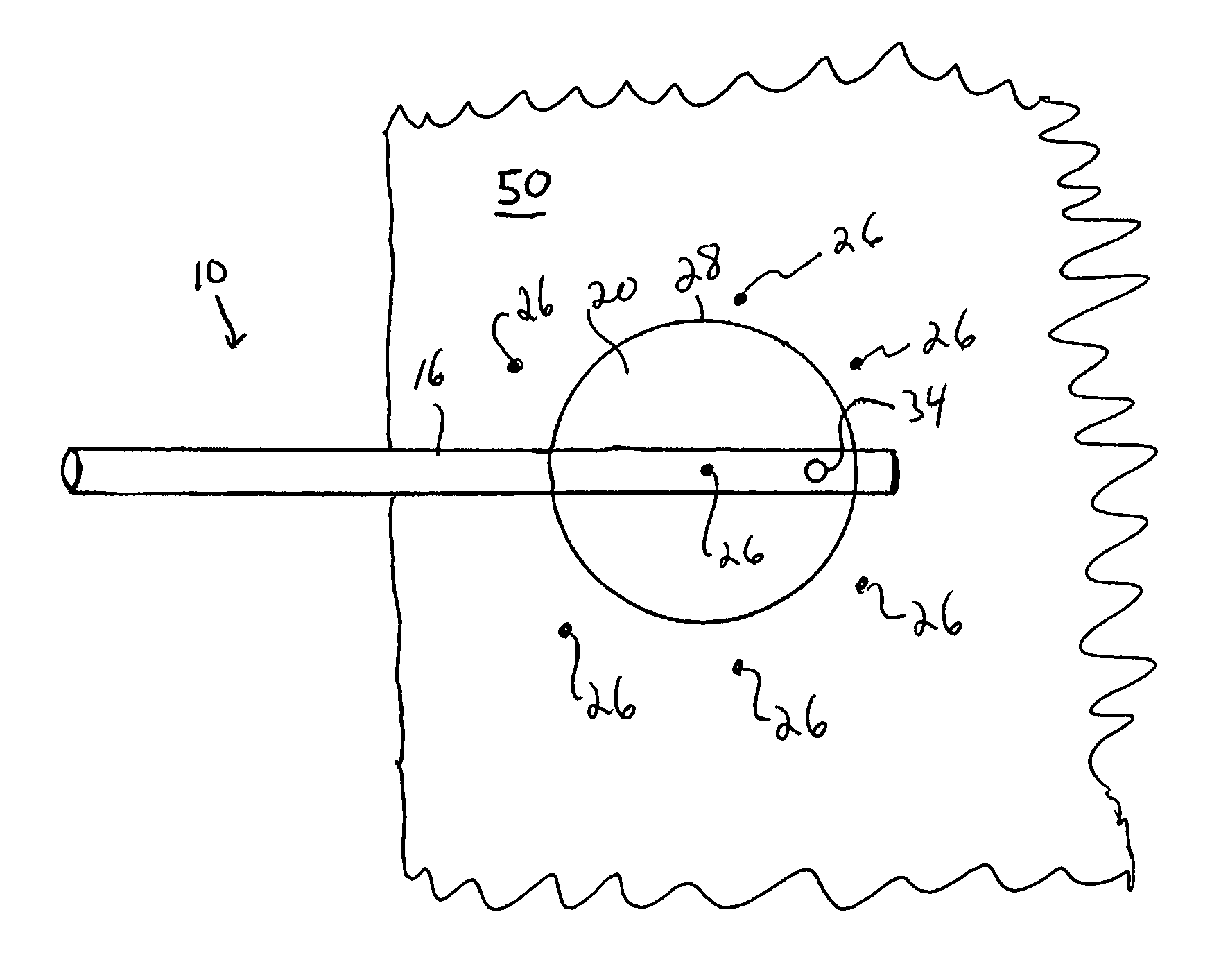 Implantable radiotherapy/brachytherapy radiation detecting apparatus and methods