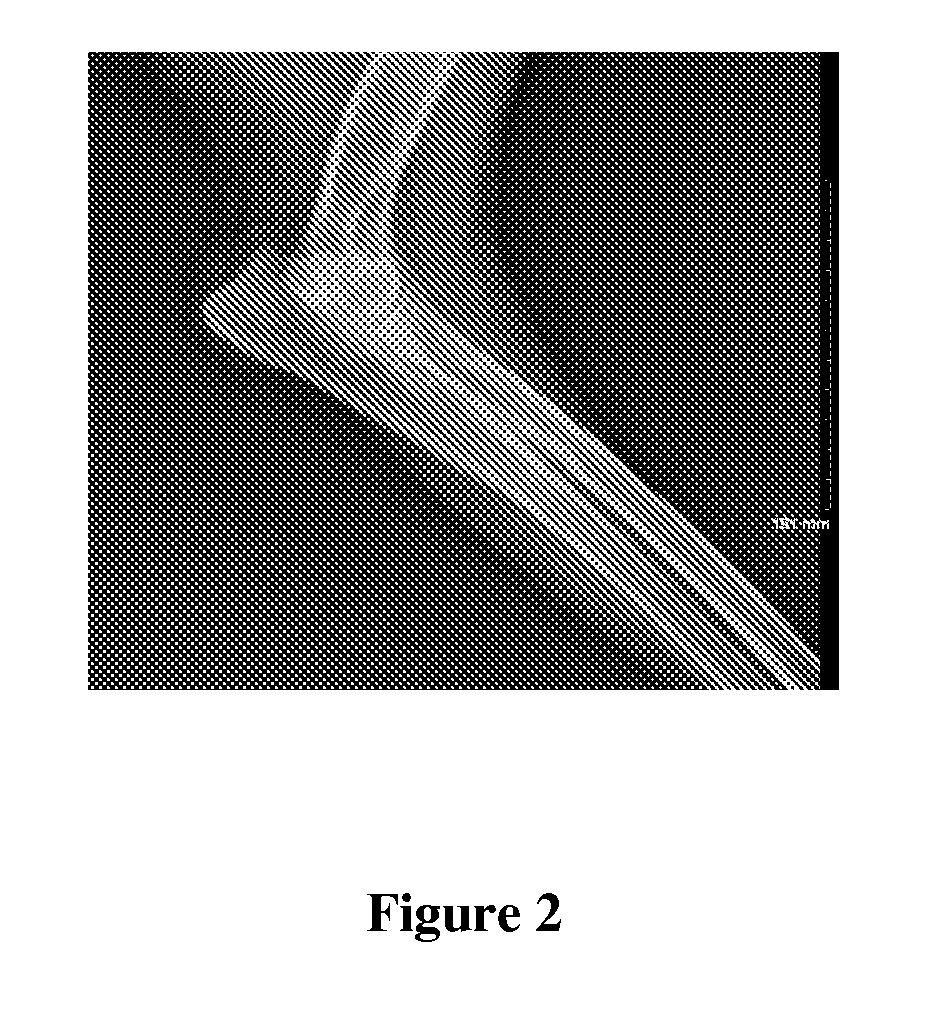 Methods for Treatment of Tumors by Direct Administration of a Radioisotope