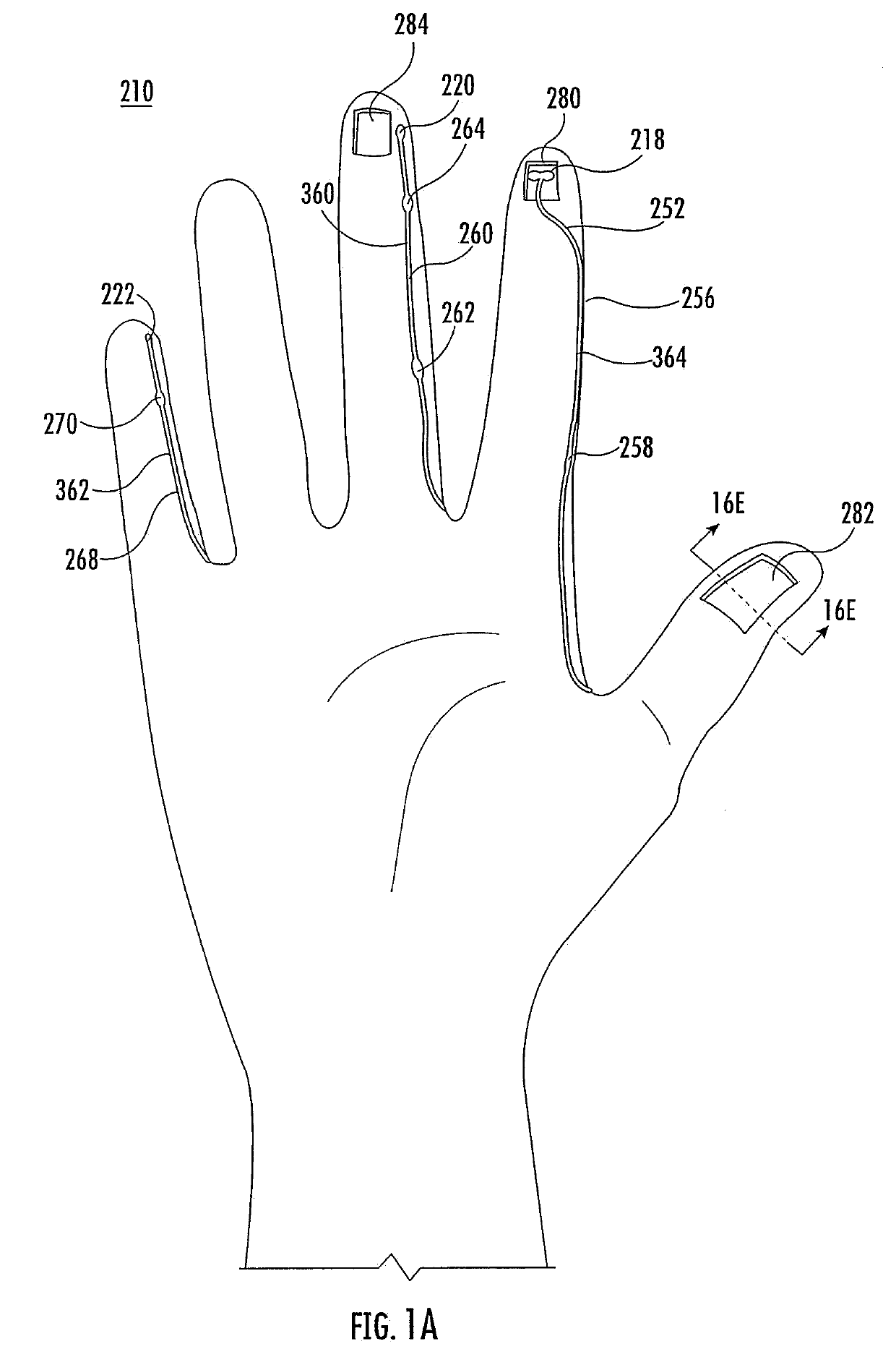 Polymeric gloves having embedded surgical support systems and discrete elements