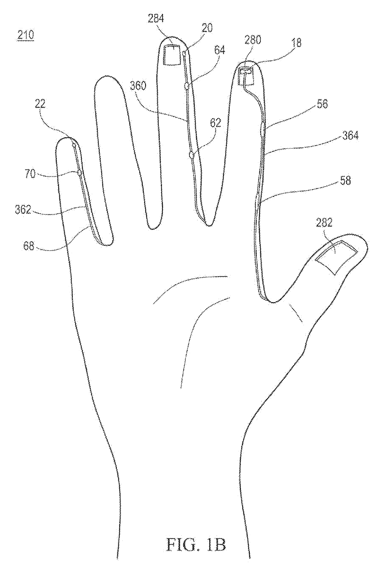 Polymeric gloves having embedded surgical support systems and discrete elements