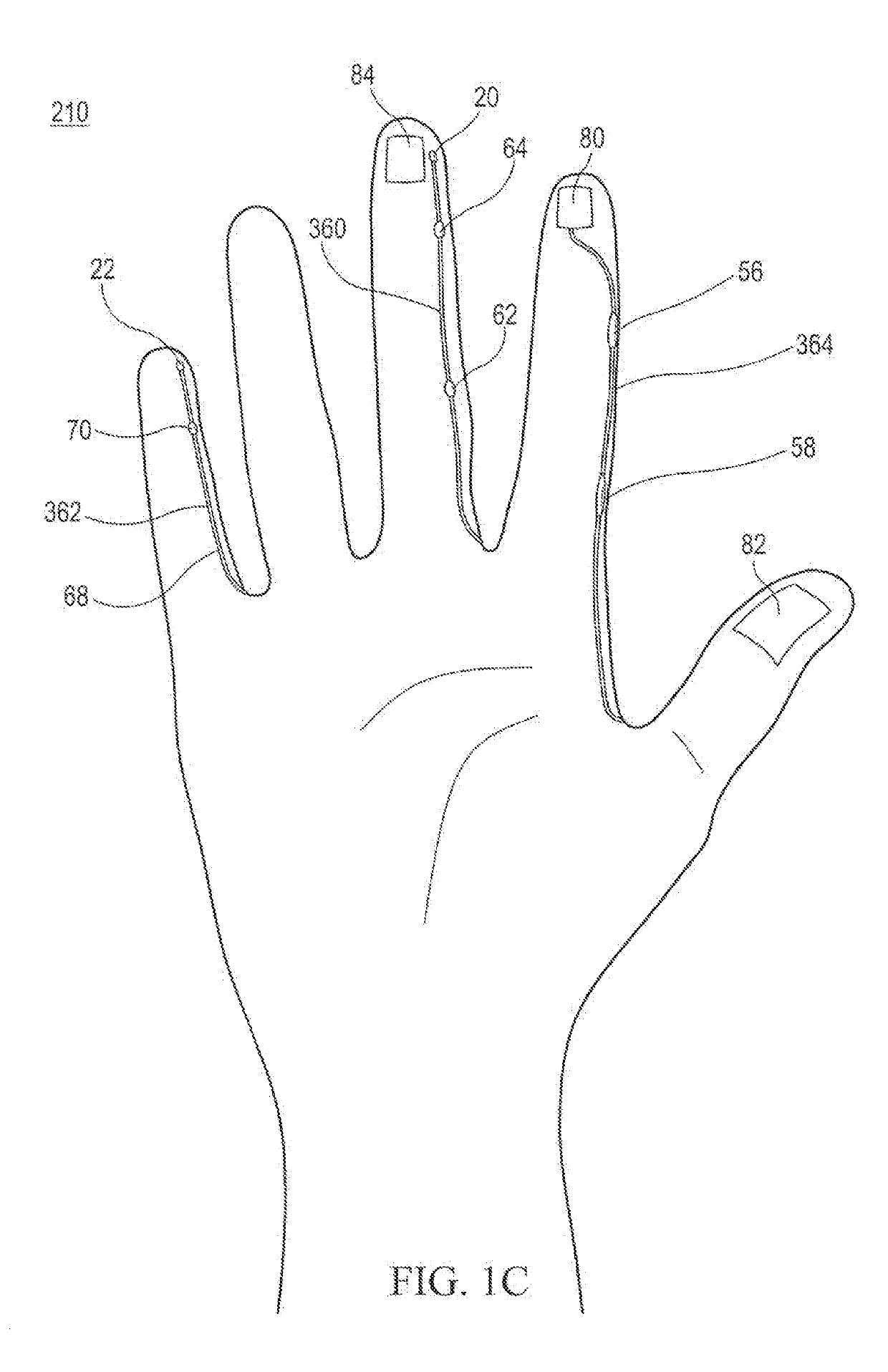 Polymeric gloves having embedded surgical support systems and discrete elements