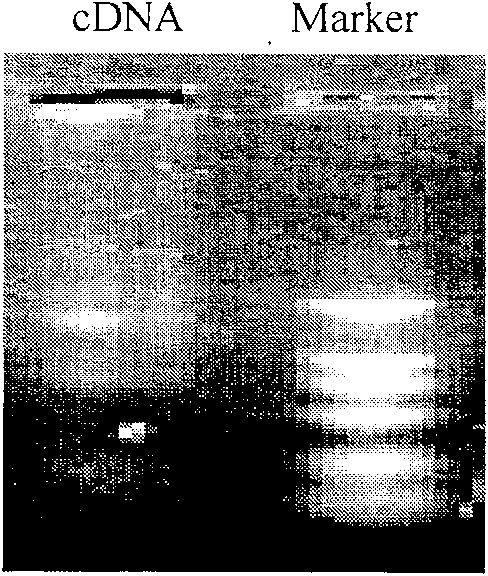 Human source anti-A botulinum neurotoxin genetic engineering antibody and preparation method and use thereof