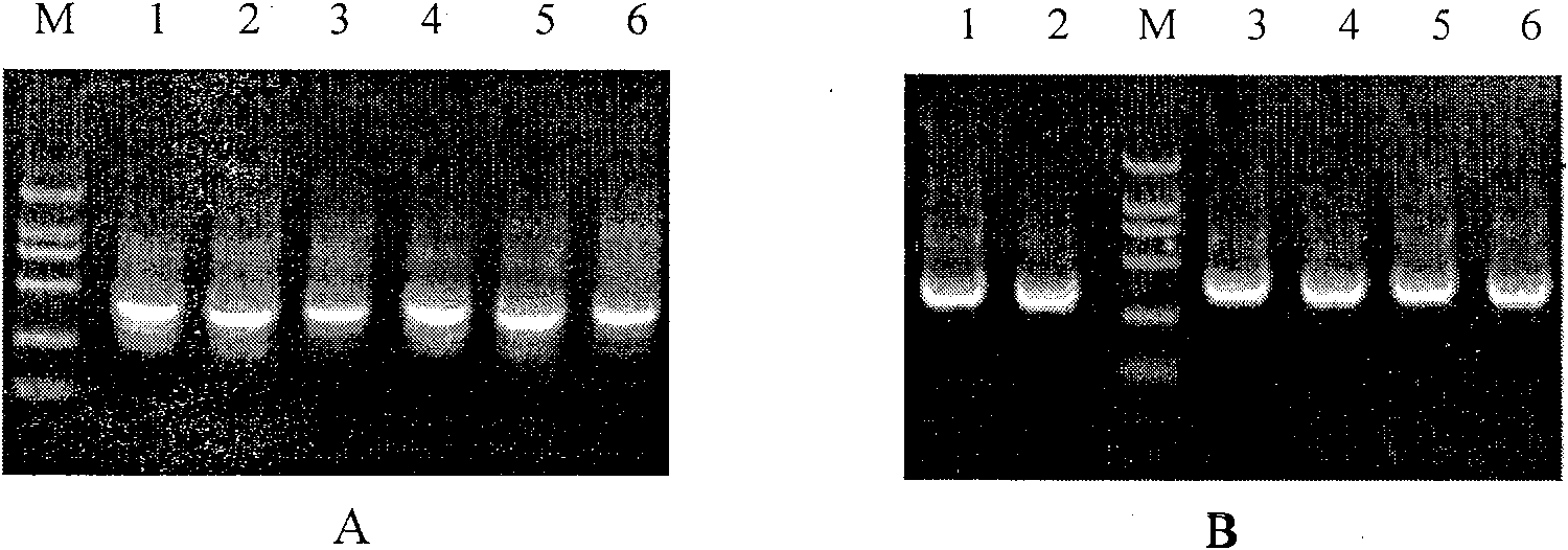 Human source anti-A botulinum neurotoxin genetic engineering antibody and preparation method and use thereof