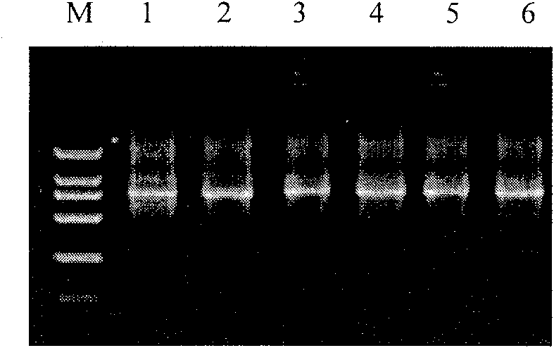 Human source anti-A botulinum neurotoxin genetic engineering antibody and preparation method and use thereof