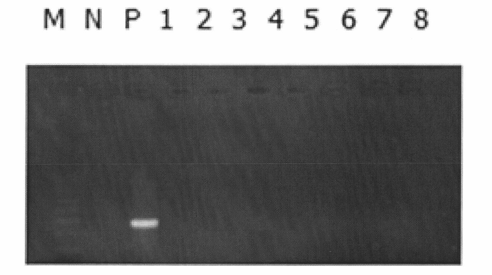 Kit for specific PCR (polymerase chain reaction) detection of pneumocystis and detection method thereof