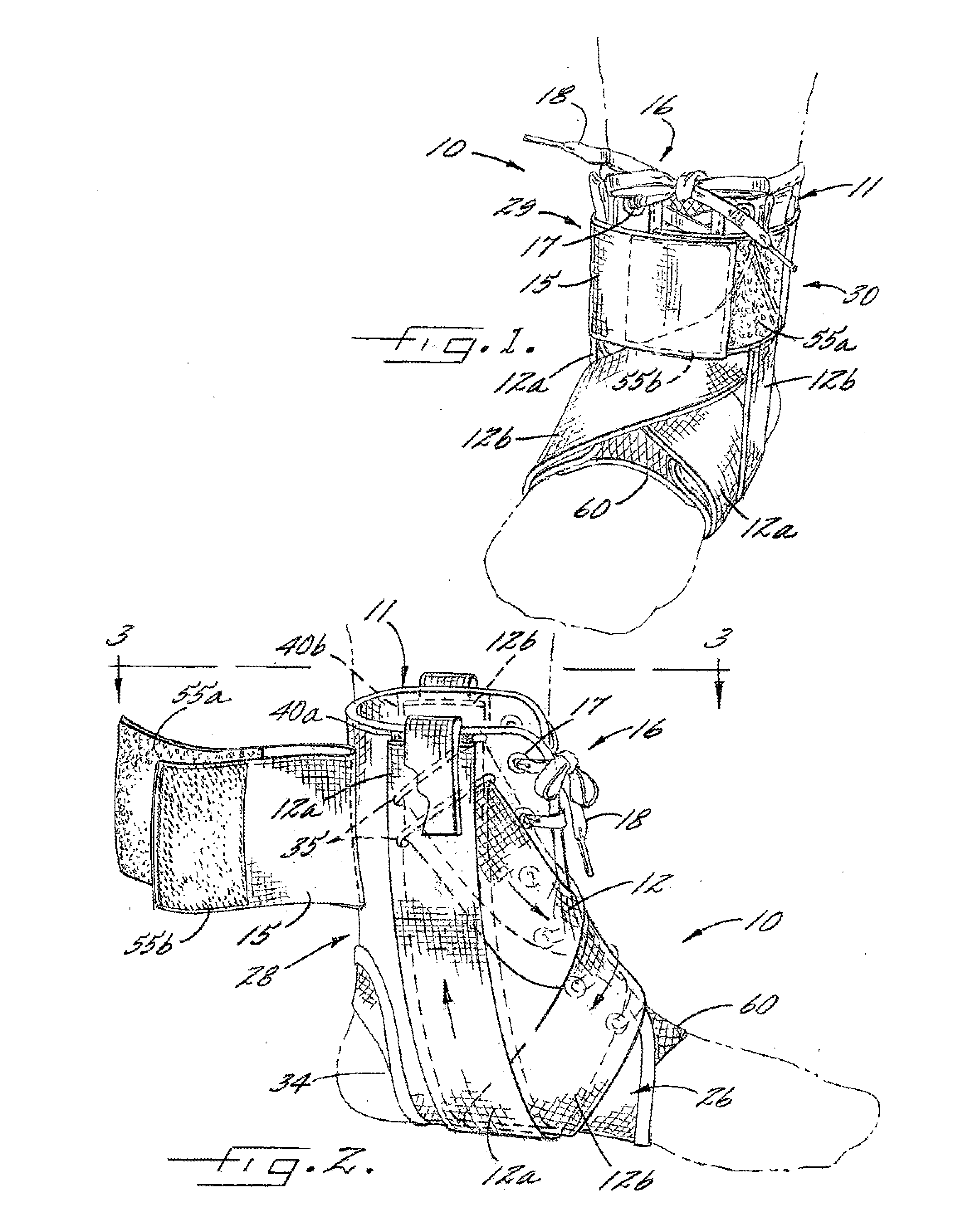 Ankle stabilizing apparatus having a dynamic cuff and stabilizing strap system