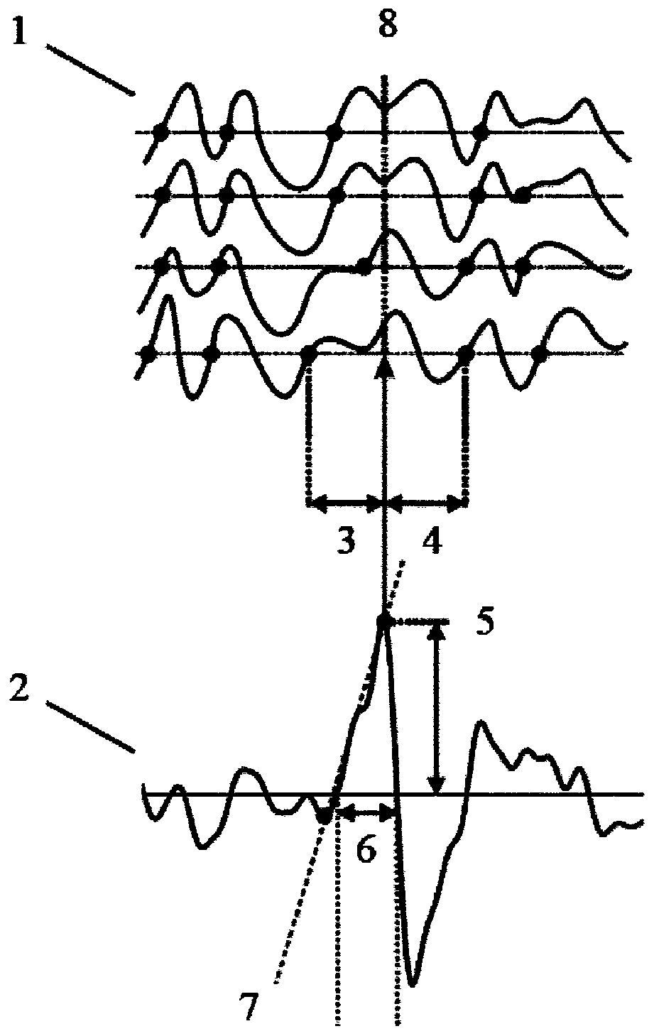 Method for identification of pathological brain activity from scalp electroencephalogram