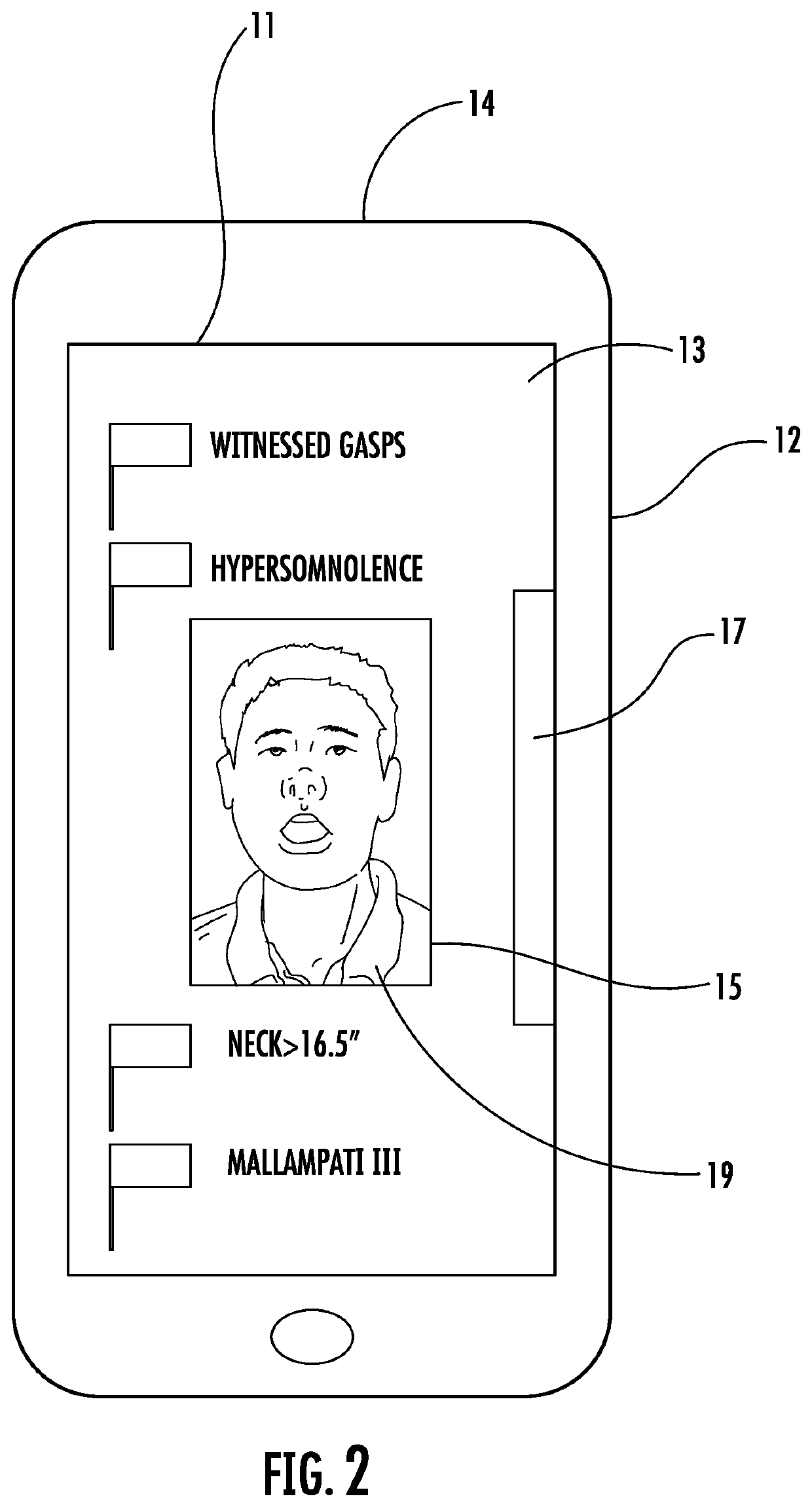 Method and system for diagnosis and prediction of treatment effectiveness for sleep apnea