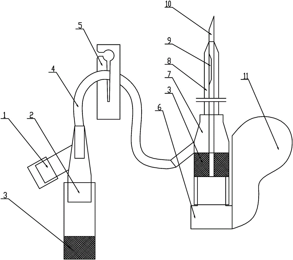 Indwelling needle for venous blood collection