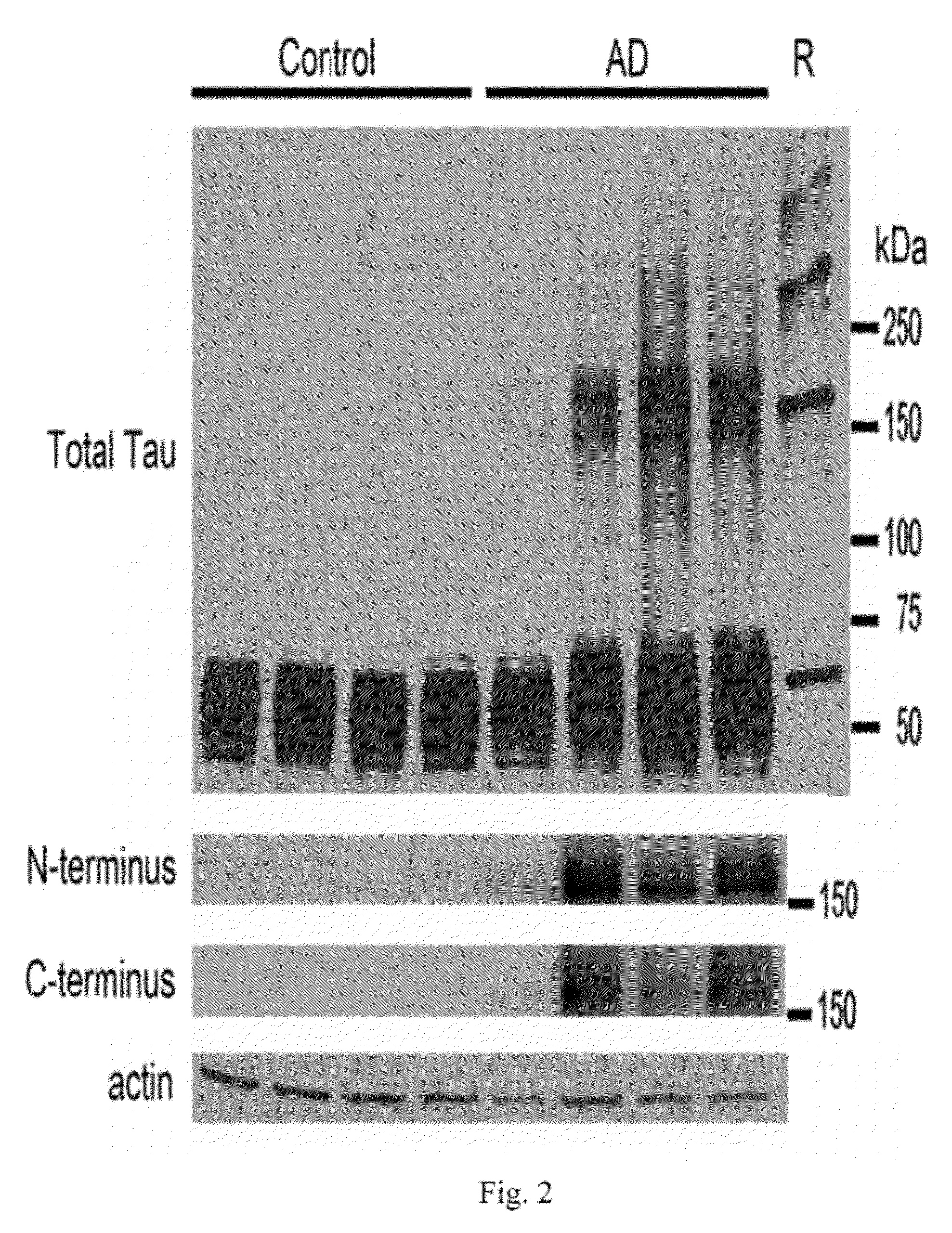 Antibodies selective for pathological tau dimers and prefibrillar pathological tau oligomers and their uses in treatment, diagnosis and monitoring of tauopathies