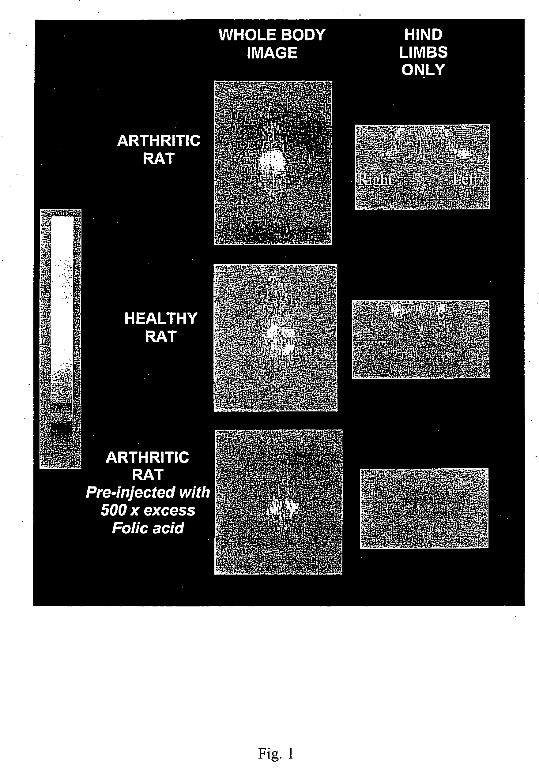 Diagnosis of macrophage mediated disease