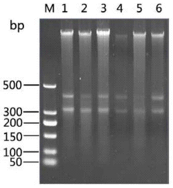 Method for extraction and diversity analysis of microbial total DNA in ship ballast water