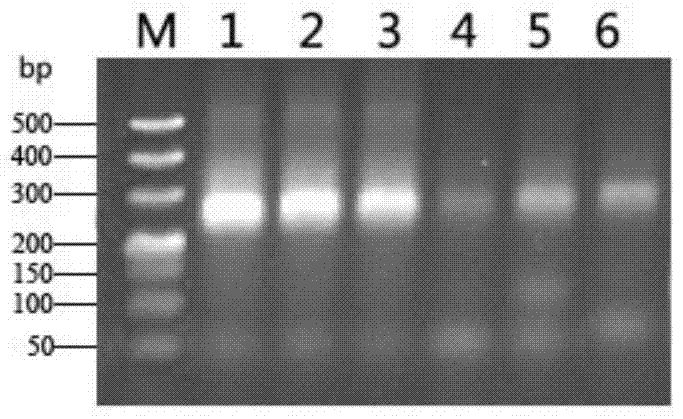 Method for extraction and diversity analysis of microbial total DNA in ship ballast water