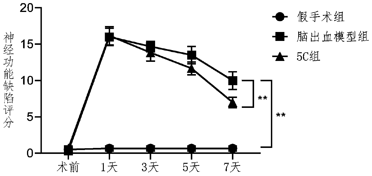 Application of sphingosine kinase 1 inhibitor in preparation of medicine for preventing and/or treating secondary brain injury after cerebral hemorrhage