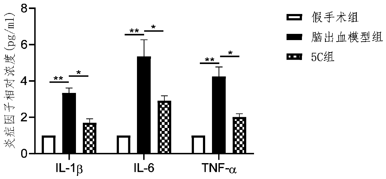 Application of sphingosine kinase 1 inhibitor in preparation of medicine for preventing and/or treating secondary brain injury after cerebral hemorrhage