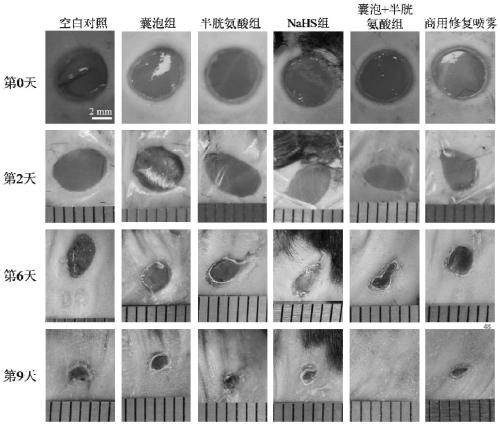 Polymer vesicle capable of promoting wound healing, and preparation method and application of polymer vesicle capable of promoting wound healing