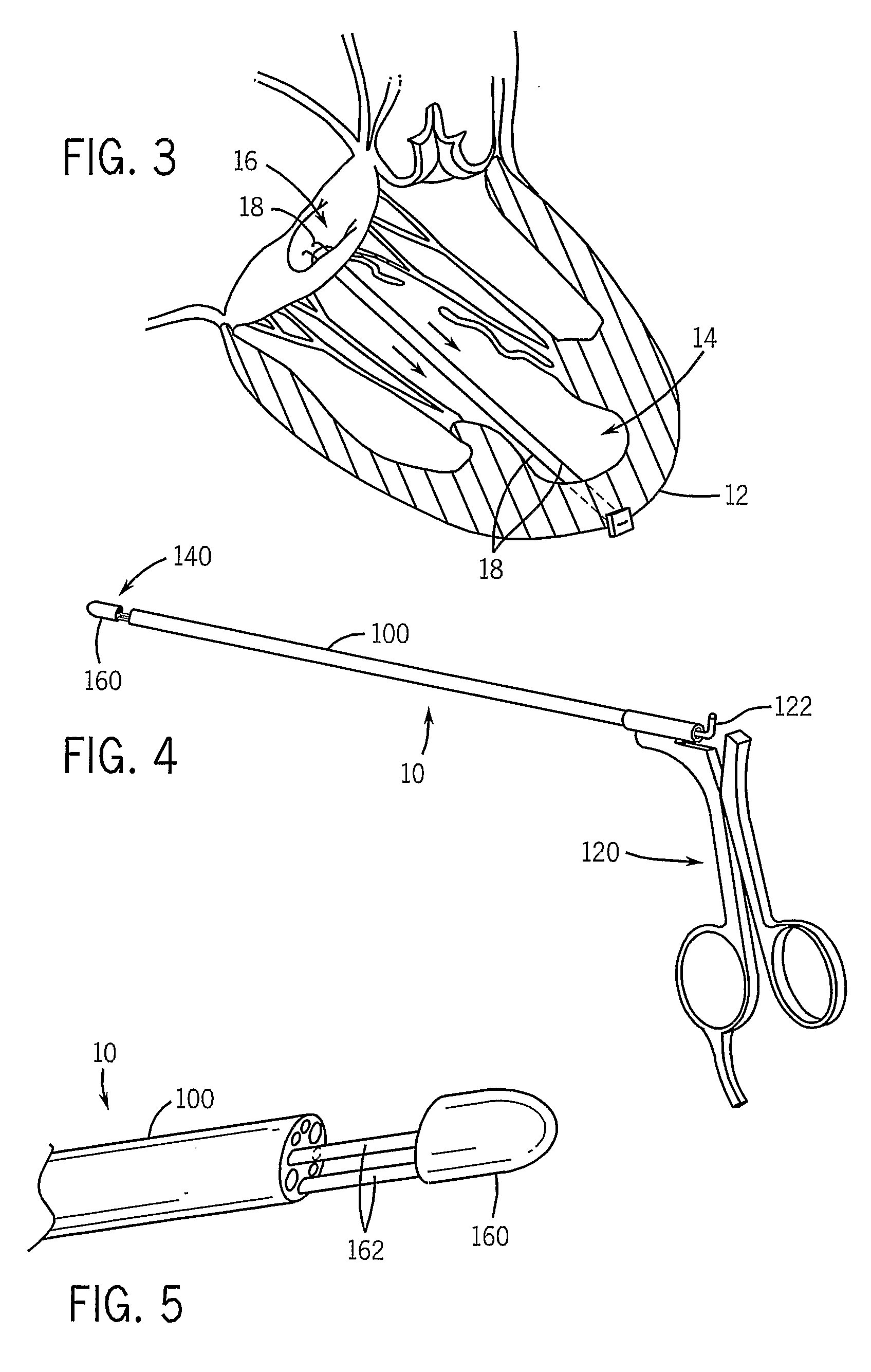 Thorascopic Heart Valve Repair Method and Apparatus