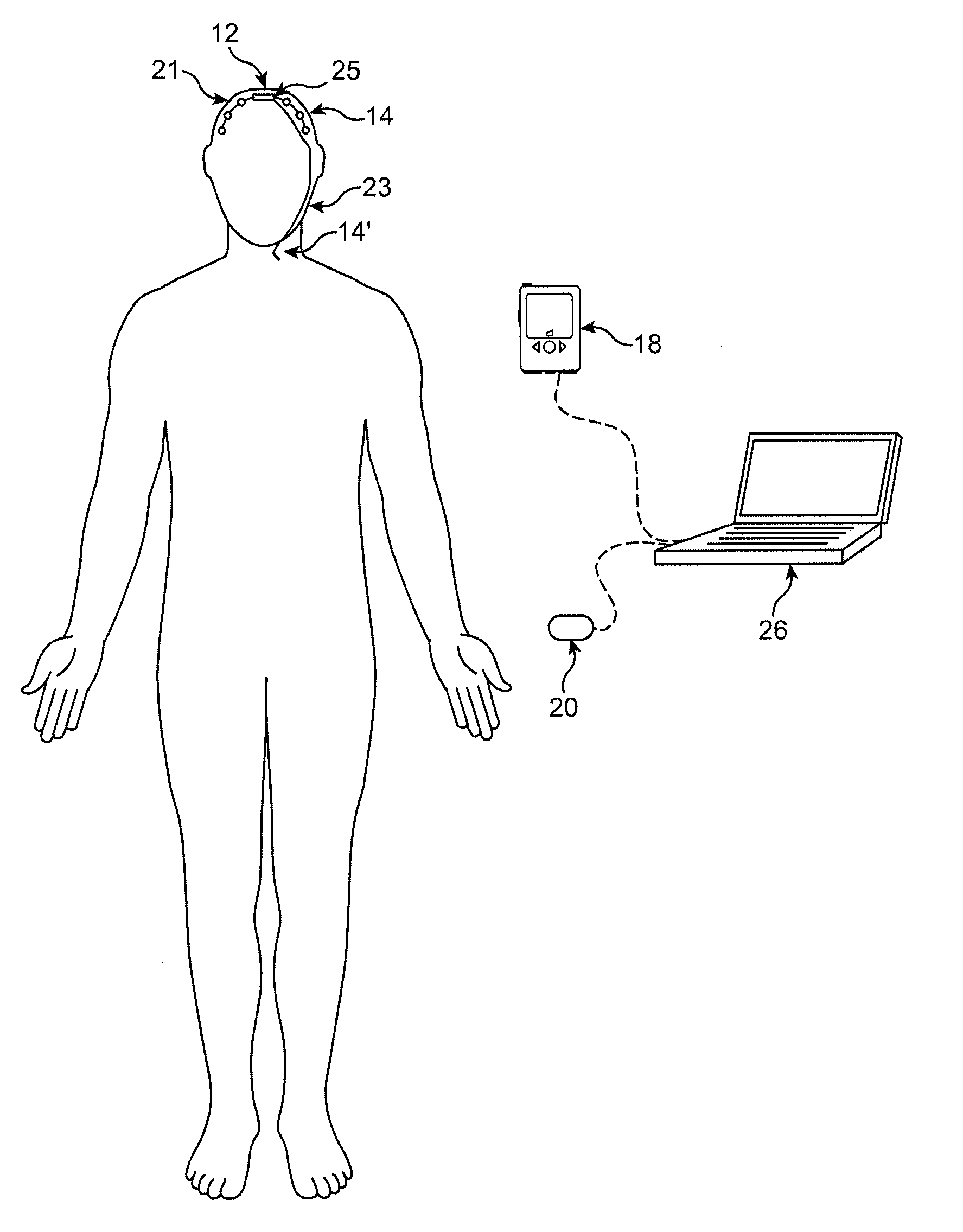 Methods and systems for administering an appropriate pharmacological treatment to a patient for managing epilepsy and other neurological disorders