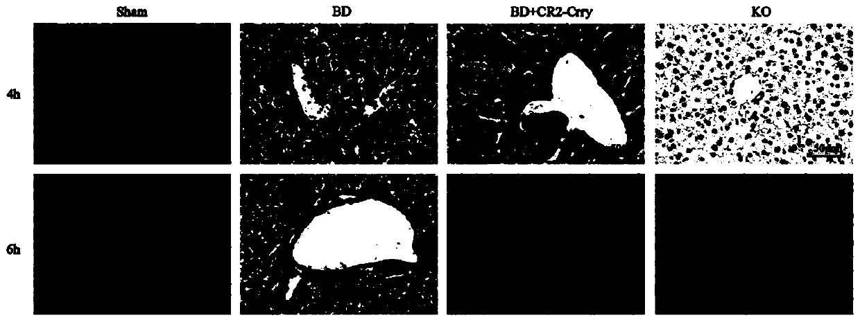 Application of targeted complement inhibitors in the preparation of drugs for improving brain-dead donor livers