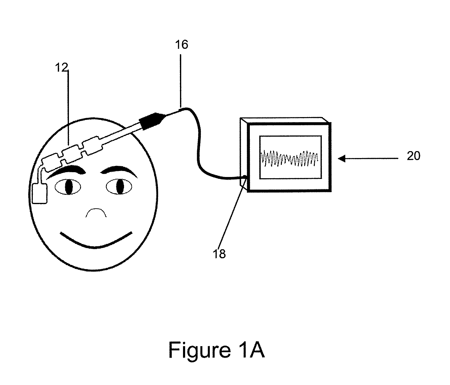 Skin preparation device and biopotential sensor