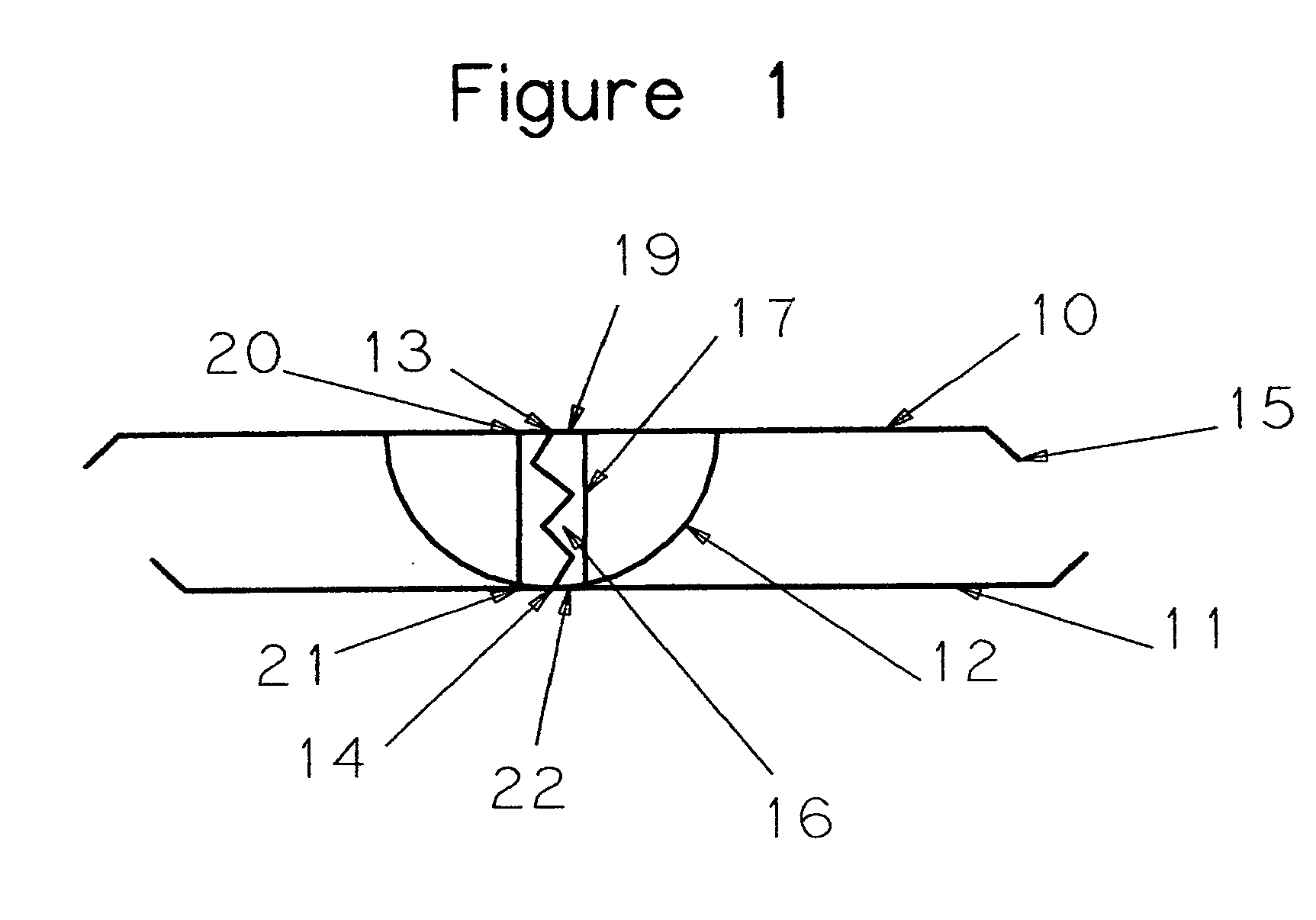 Rehabilitation apparatus for lumbosacral spine