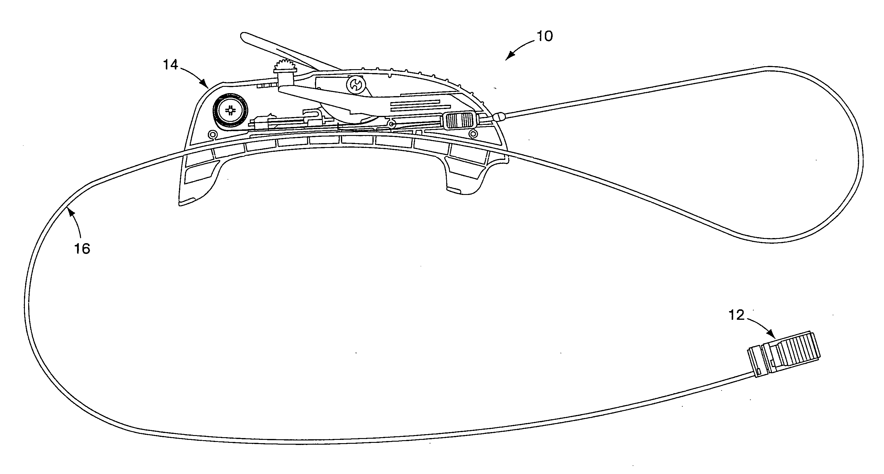 External endoscopic acessory control system