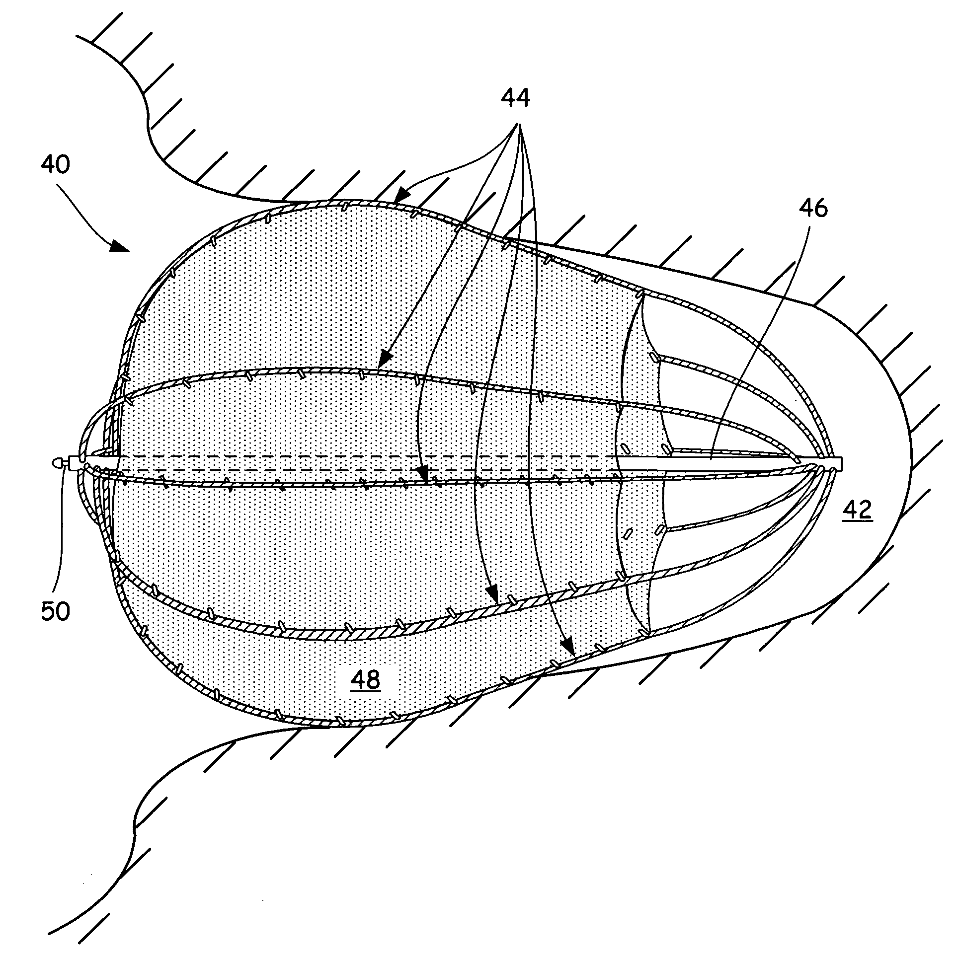 Left atrial appendage closure device