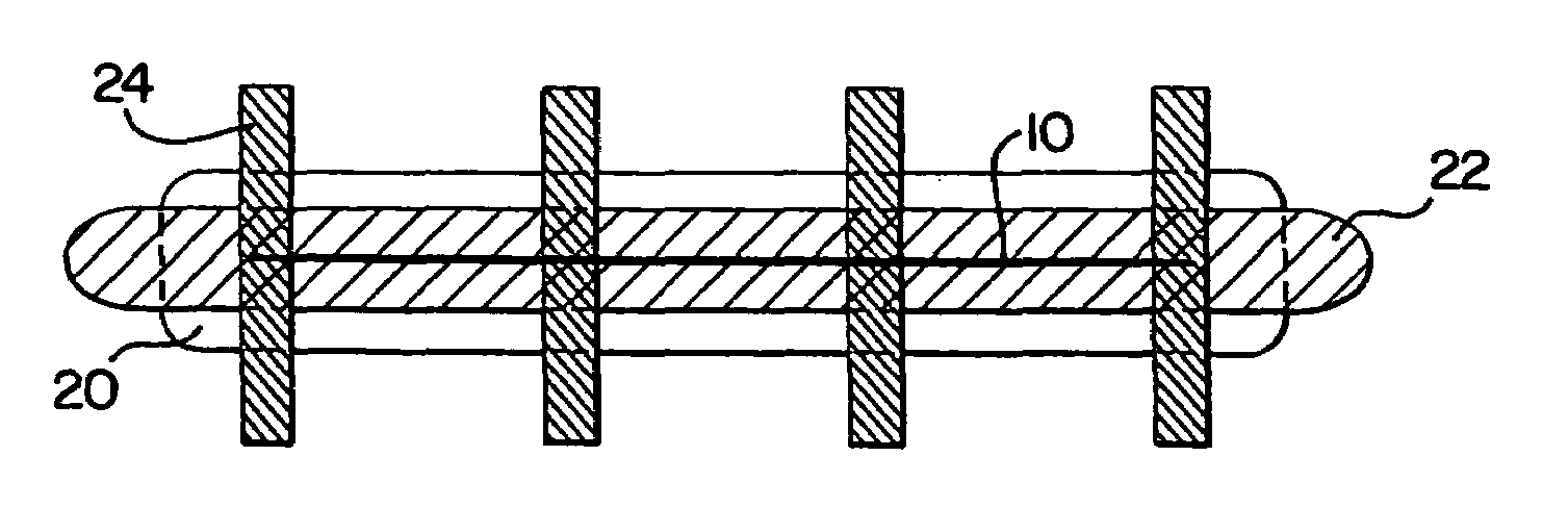 Dressing for treatment of short wounds located in high tension areas