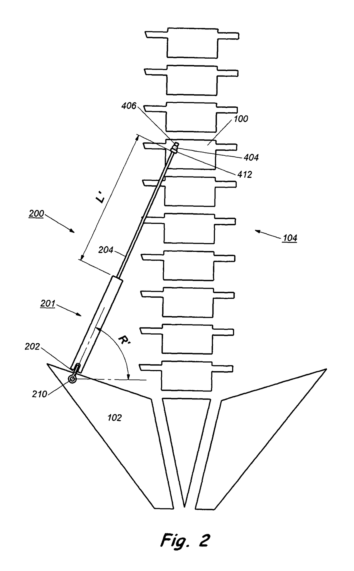 Device and method for treatment of spinal deformity